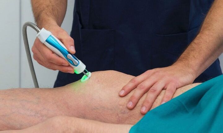 termografia stawu kolanowego z artrozą